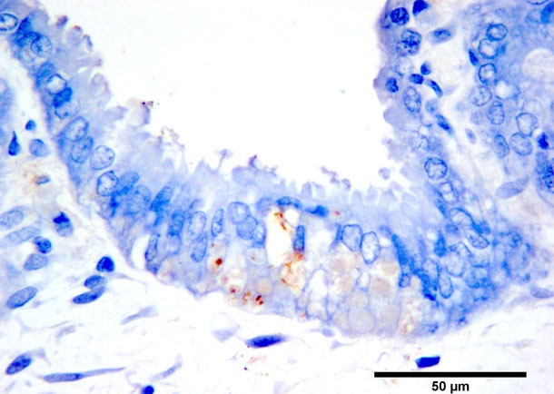 Immunhistochemische Braunfärbung von PCV2b Antigen in nekrotischen Trophoblasten.
Chromogen Diaminobenzidin, Gegenfärbung mit Hämatoxylin.