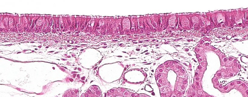 Abbildung 1: F&uuml;r den Atemtrakt charakteristisches pseudostratifiziertes Flimmerepithel mit Becherzellen
