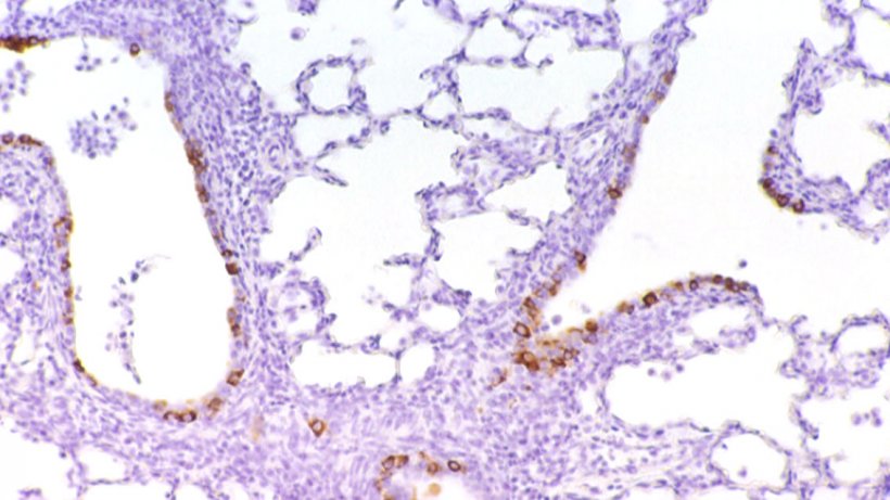 Abbildung 6: F&uuml;r PRCV im Bronchialepithel immunmarkierte Zellen
