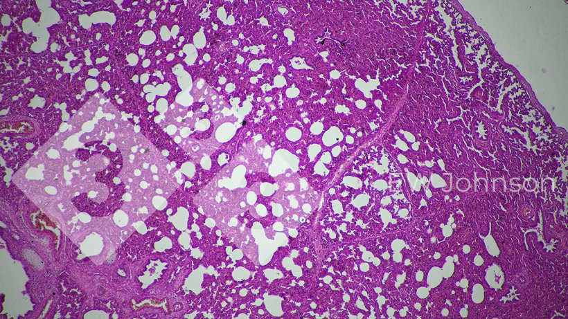 Abbildung 3: Interstitielle Pneumonie deutet auf eine m&ouml;gliche virale Ursache hin
