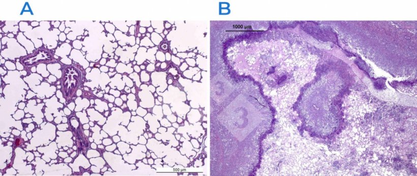 Abb. 2: H&auml;matoxylin- und Eosinf&auml;rbung in einer normalen (A) und einer gesch&auml;digten (B) Lunge. Die Lunge in B ist von einer fibrin&ouml;s-nekrotisierenden Pleuropneumonie betroffen, die durch Actinobacillus pleuropneumoniae verursacht wurde.
