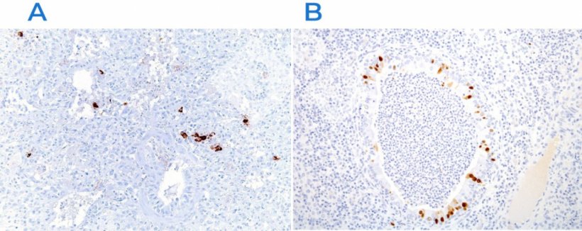 Abb. 3: Immunhistochemie zum Nachweis des Virus des porzinen reproduktiven und respiratorischen Syndroms (PRRSV) (A) und des Schweineinfluenzavirus (B). In den gesch&auml;digten Bereichen sind virale Antigene (braune F&auml;rbung) vorhanden.
