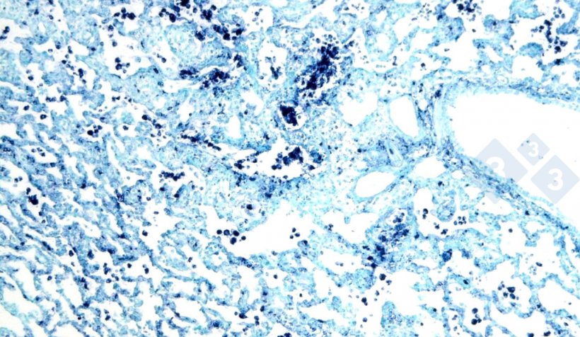 Abb. 4: In-situ-Hybridisierung zum Nachweis des porzinen Circovirus 2 (PCV-2) in einer von interstitieller Pneumonie betroffenen Lunge.
